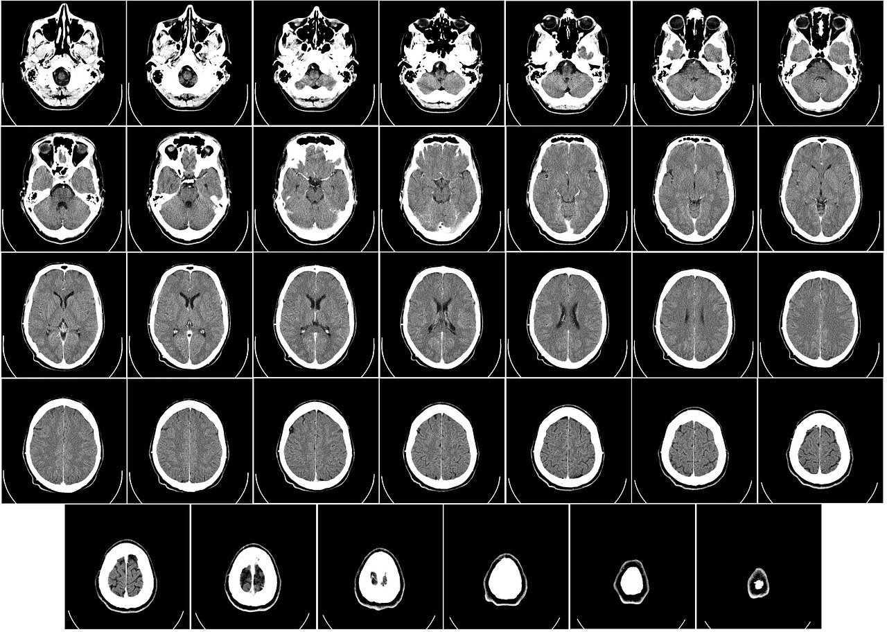 computer tomography, ct, radiography.jpg